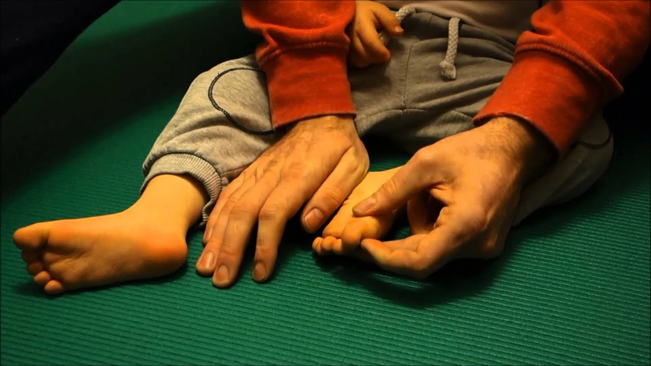 Staszek - Fistaszek: (zespół Downa) Masaż zmniejszający koślawość stóp