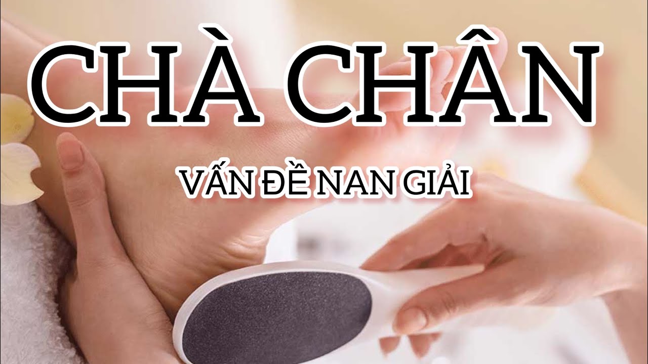 CHÀ CHÂN $5 mất cả thanh xuân