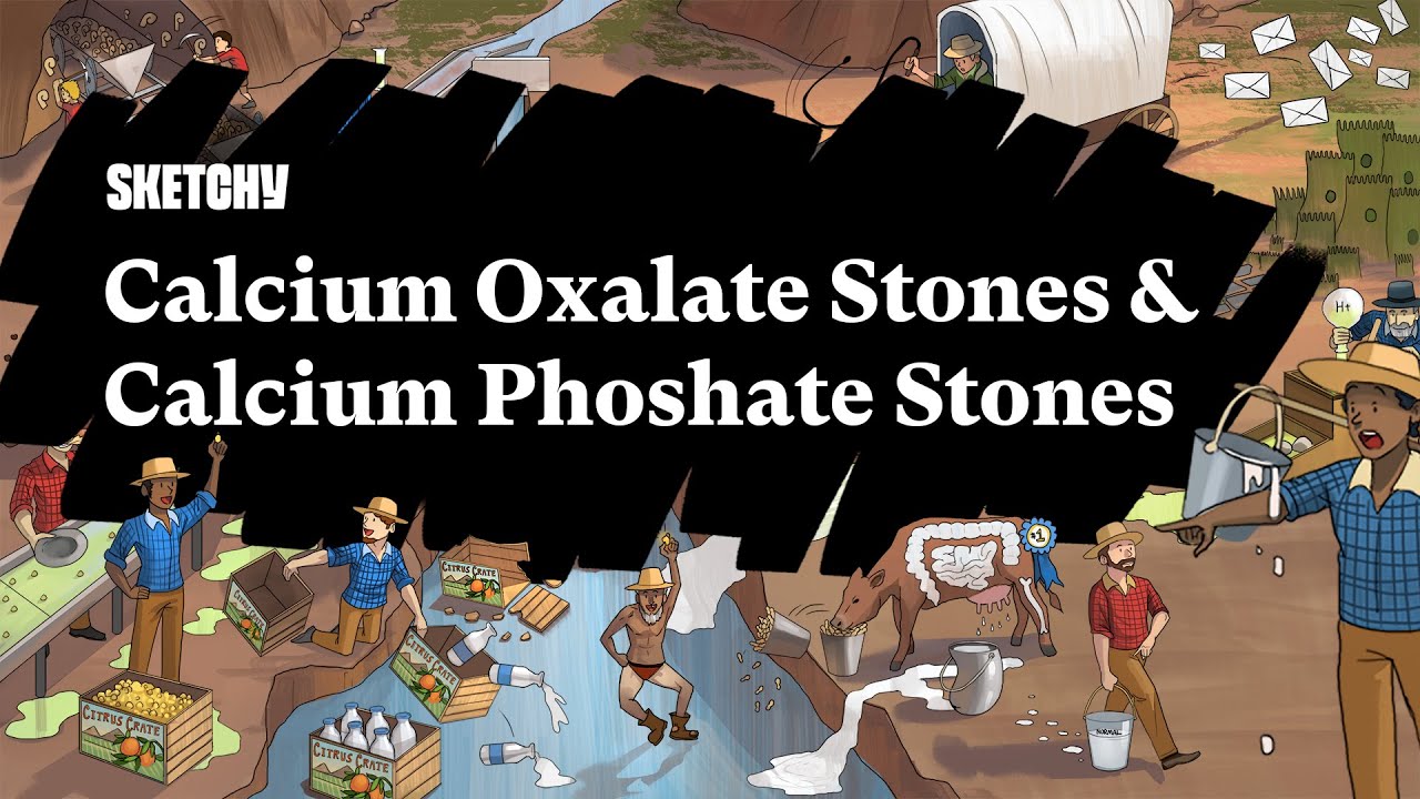 Calcium Oxalate and Phosphate Stones (Part 1) | Sketchy Medical  | USMLE Step 1