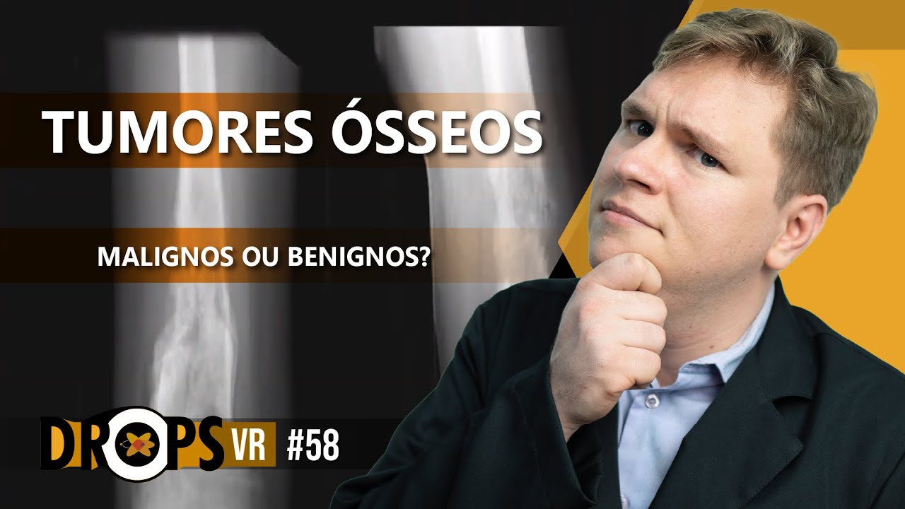 COMO DIFERENCIAR TUMORES ÓSSEOS MALIGNOS E BENIGNOS NA RADIOGRAFIA