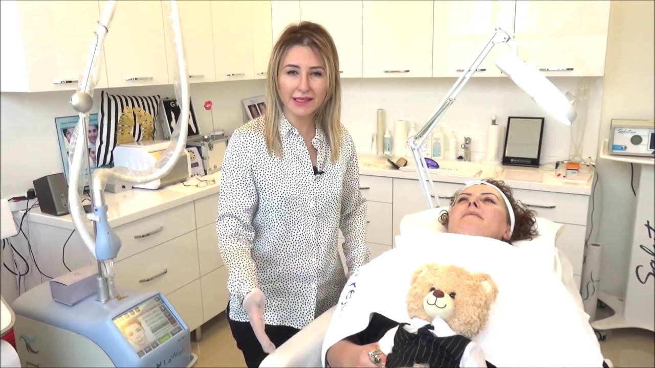 Thulium lazer kullanılarak baby face uygulaması