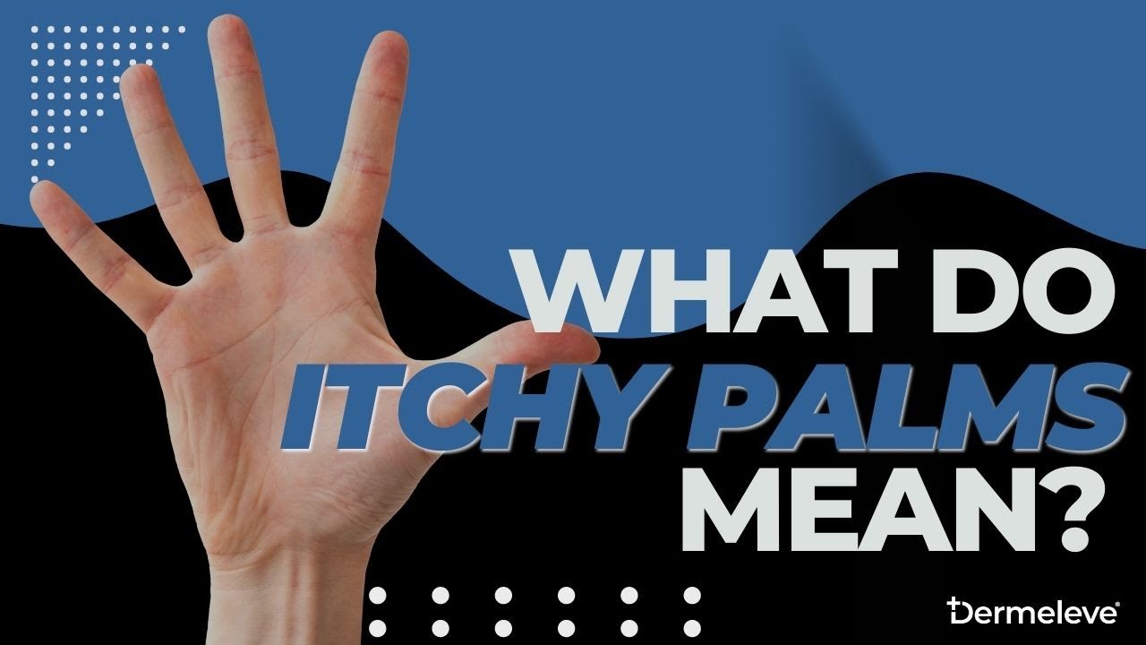 What Do Itchy Palms Mean? - Dermeleve&reg;