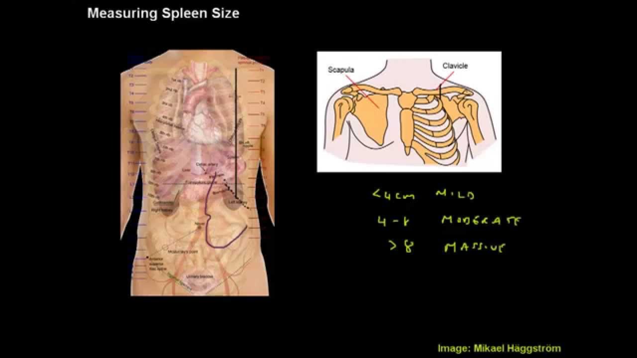 Measuring Spleen Size - Clinical Skills Made Easy
