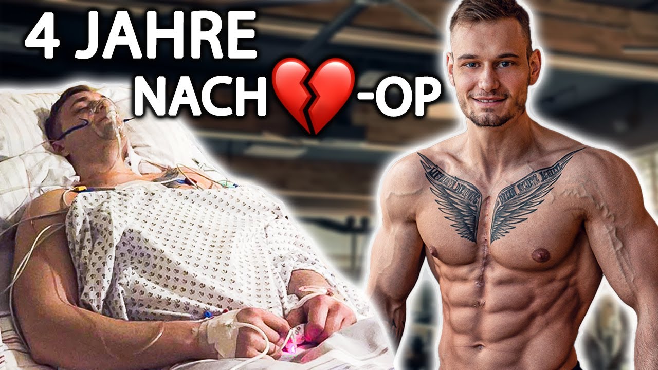 4 Jahre nach Herzop - Schlaganfall
