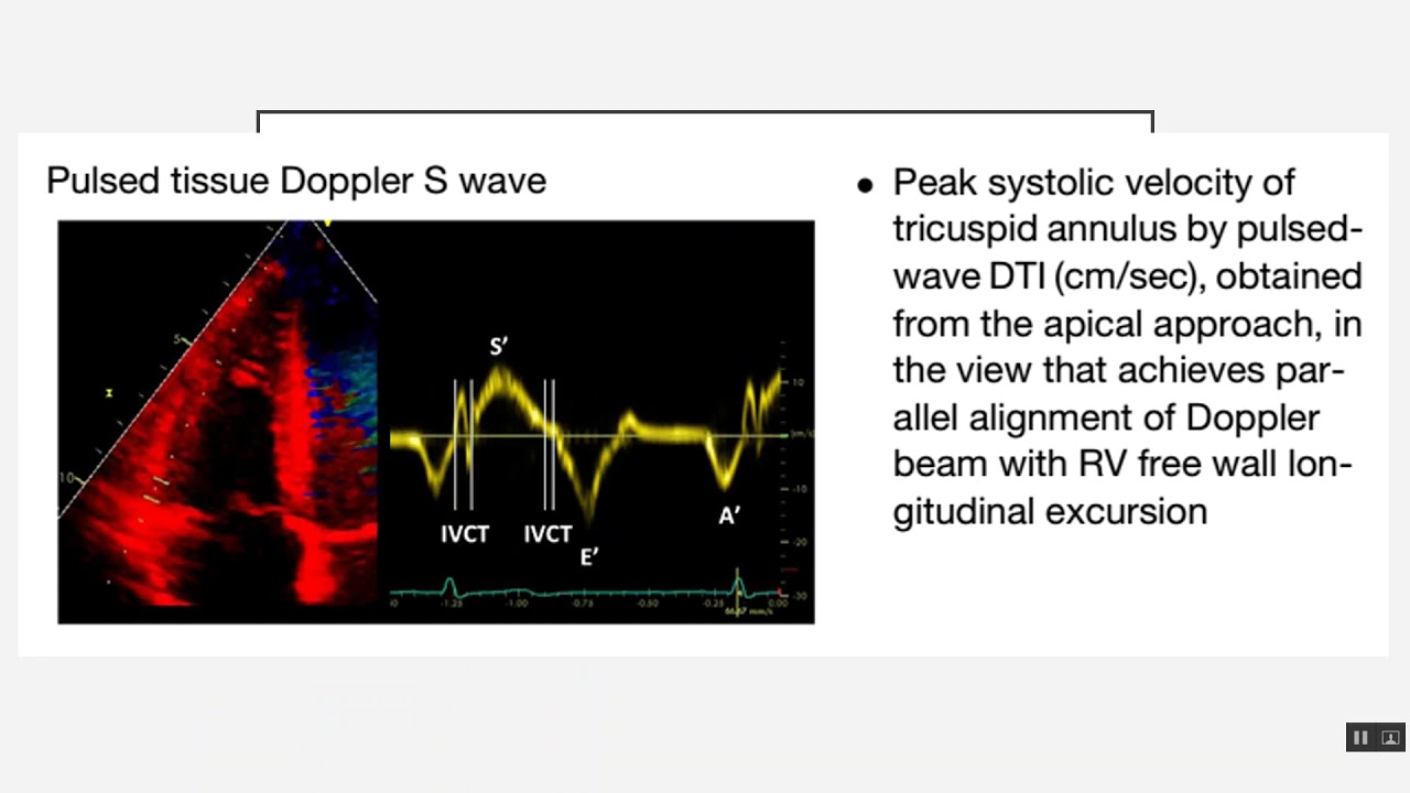 Assessment of the Right Ventricle - Dr Ahmed Samir