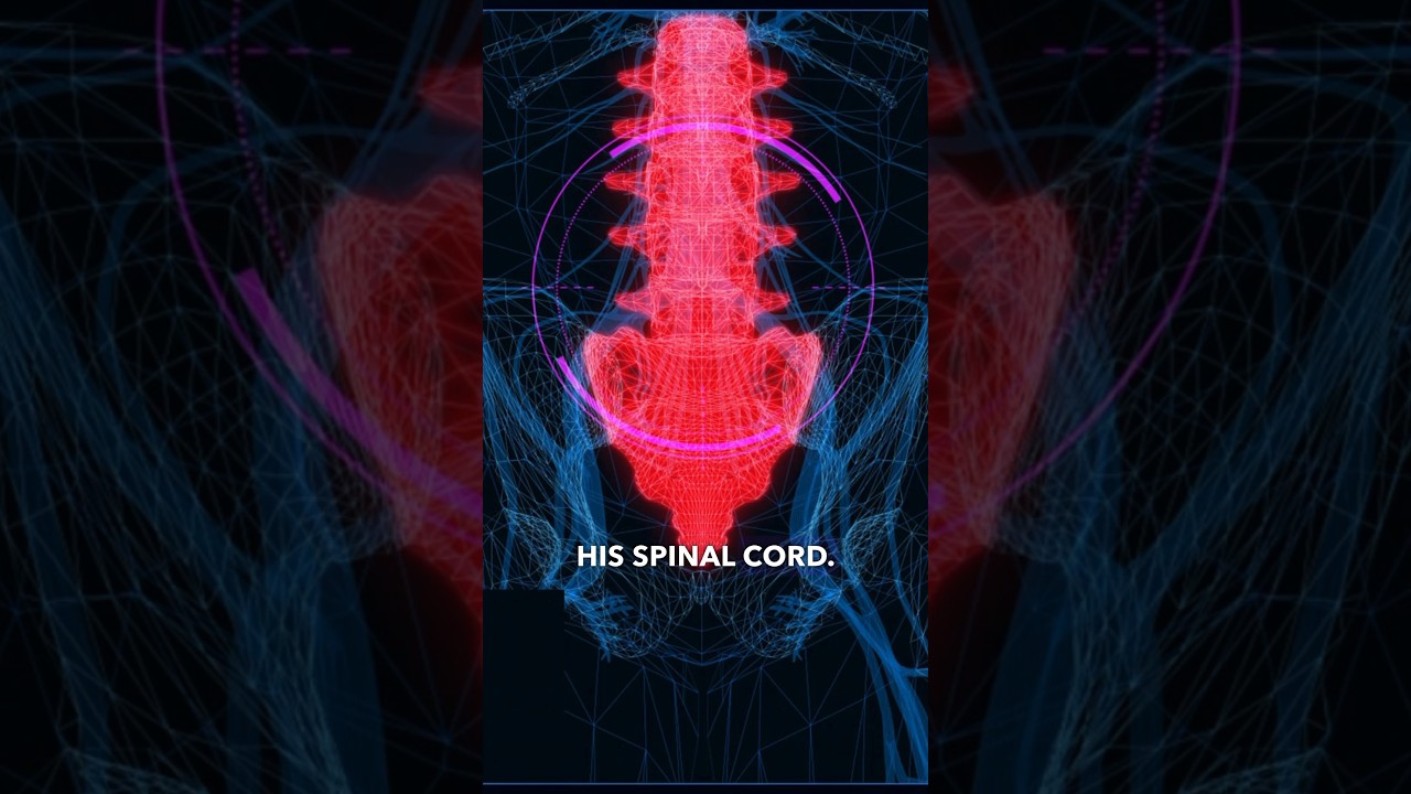 Paralyzed Man Walks Again With AI Assistance - Gert-Jan Oskam's Incredible Story