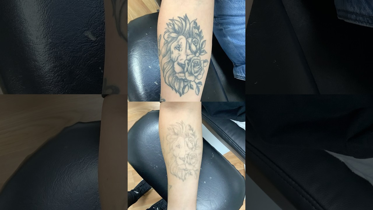 I&rsquo;m removing all of my tattoos&hellip;.#storytime #grwm #tattoo #tattooremoval