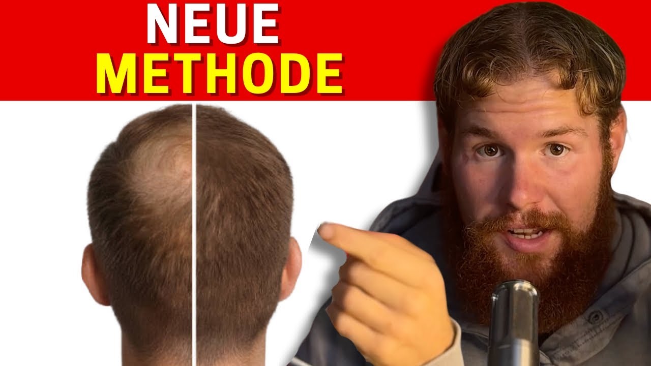 Wie ich meinen Haarausfall Umgekehrt habe (neue Studie)