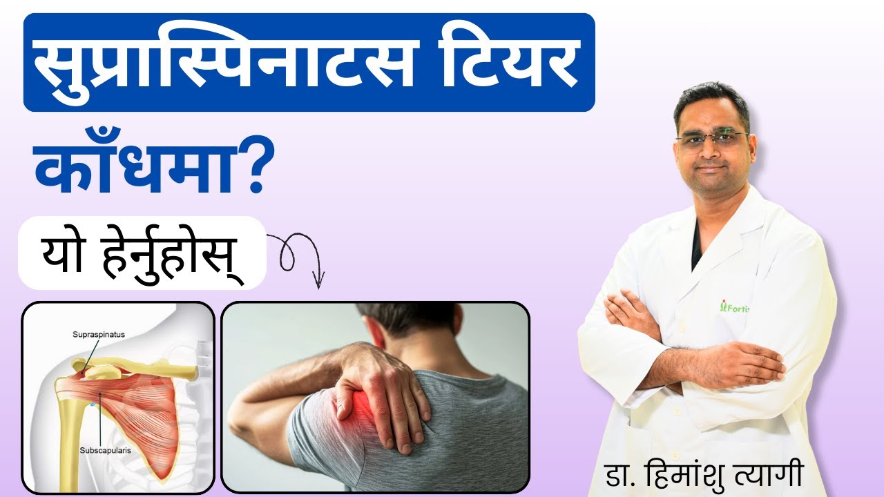 सुप्रास्पिनाटस टियर काँधमा? यो हेर्नुहोस् | Supraspinatus Tear in shoulder? in Nepali