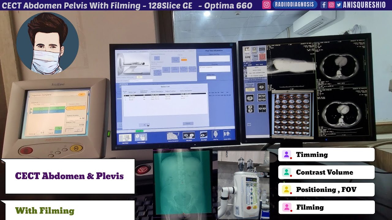 CECT Abdomen Pelvis with Filming | GE 128 Slice Optima | By Anis Qureshi