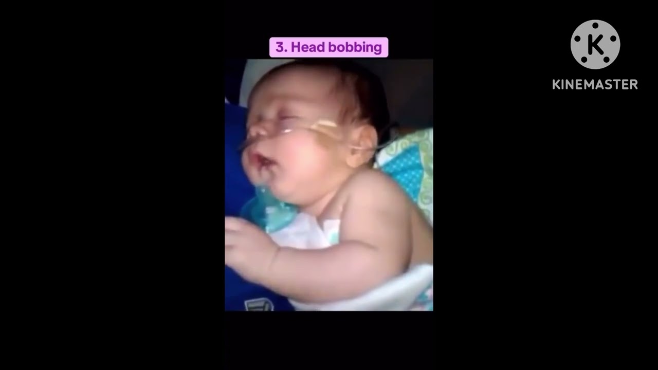 Head bobbing l Breathing difficulty l Respiratory failure #headbobbing