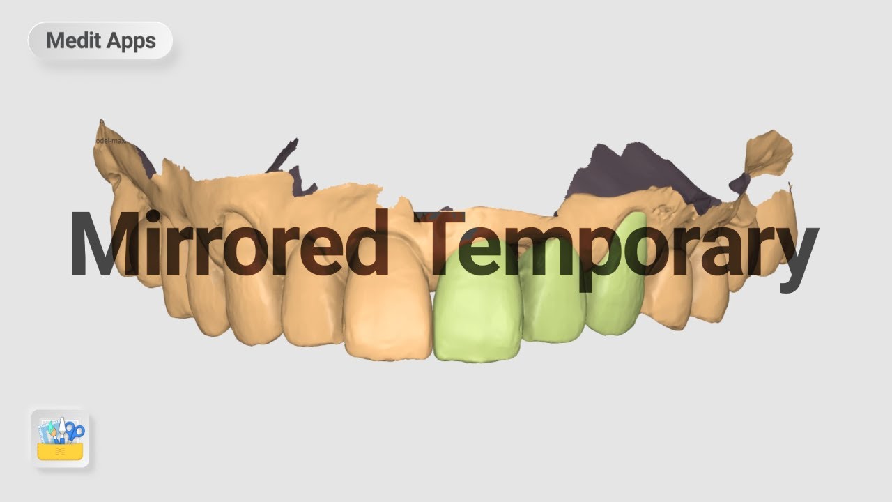 Designing a Mirrored Temporary Crown with Medit Design App