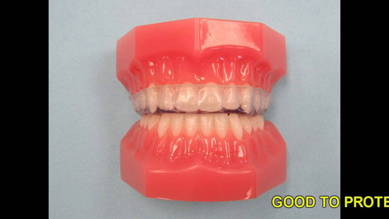 NIGHTGUARDS, SPLINTS, AND ORTHOTICS: DENTAL APPLIANCES TO PROTECT YOUR TEETH