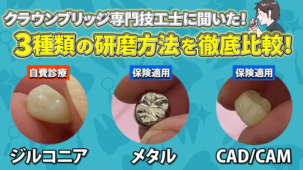 【徹底解説】ジルコニアとメタルの研磨方法の違い 仮歯/作り方【歯科技工士実演】