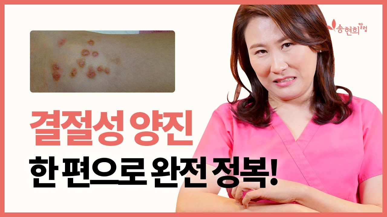가려움과의 전쟁! 양진, 결절성 양진 완전정복