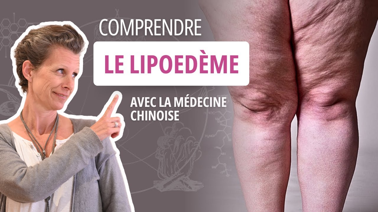 Cellulite, oed&egrave;me, jambes lourdes : la source de ces douleurs