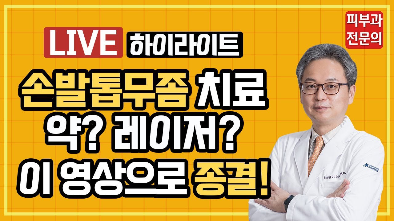 손발톱무좀 치료와 각종 논란들 속 시원히 뿌리 뽑아봤습니다! [발톱무좀 치료, 약, 레이저]