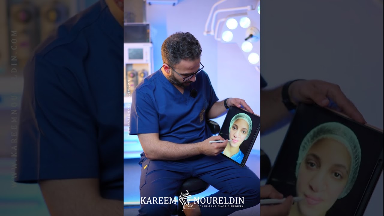 تجميل الأنف لحالات التشوهات الخلقية 👍👍