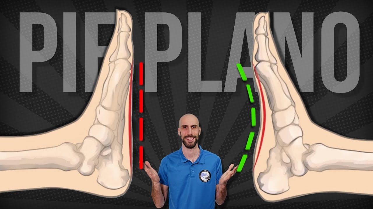 🦶🏻 Rutina de EJERCICIOS para corregir EL PIE PLANO