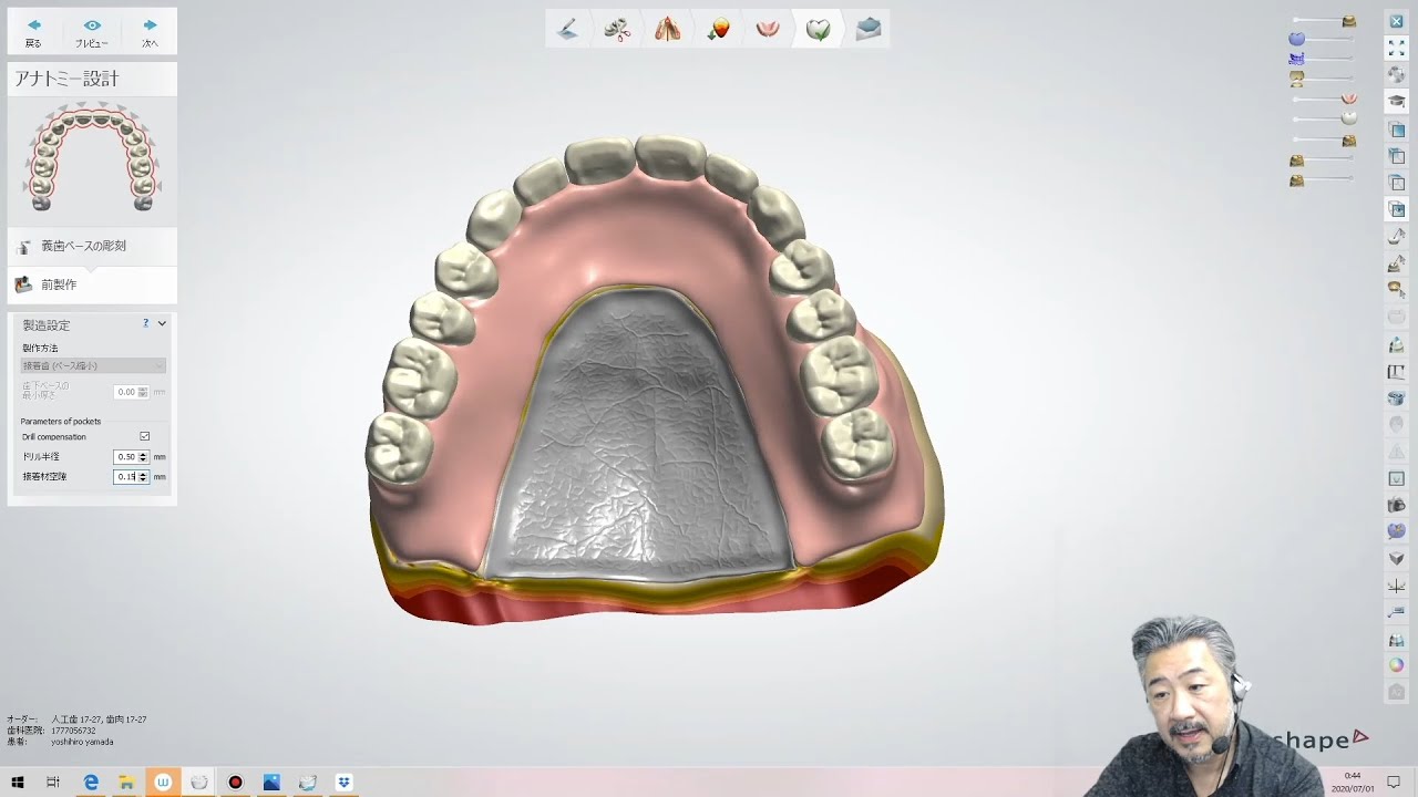 How to make a metal-based full denture with only a completely digital design.