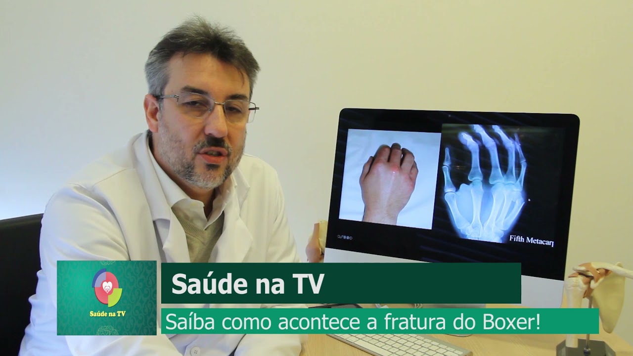 Fratura do Boxe - Dr. Dennis Barbosa - Ortopedista