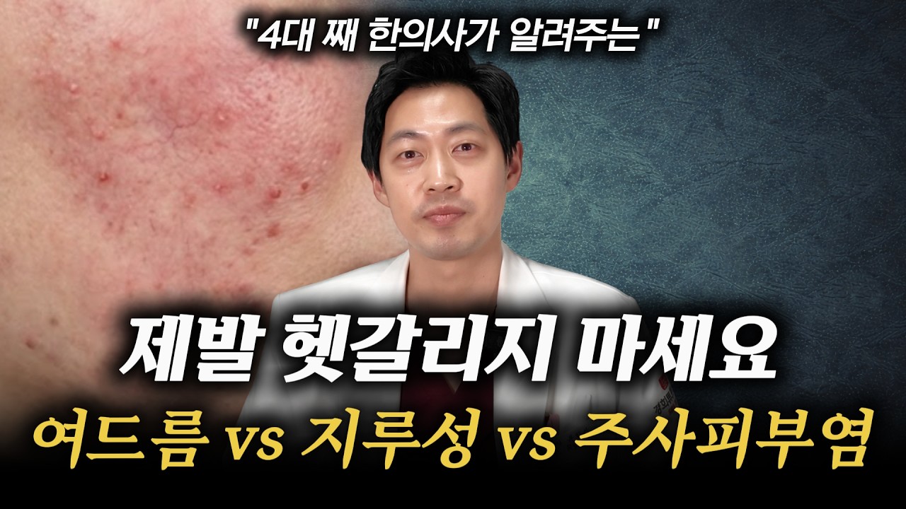 제발 헷갈리지 마세요  여드름 vs 지루성피부염 vs 주사피부염 개선의 모든 것