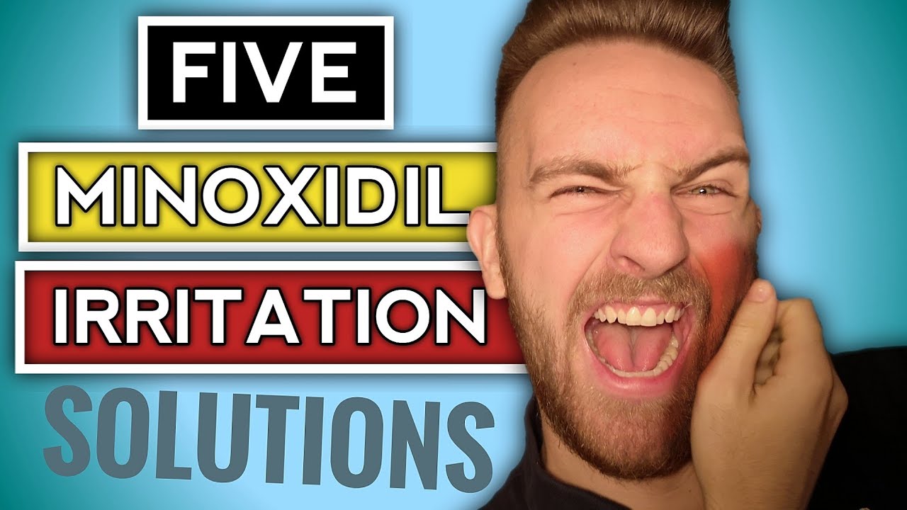 Minoxidil Dry Skin & ITCHY Rash Solution | FIVE FIXES | Minoxidil Beard Side Effects