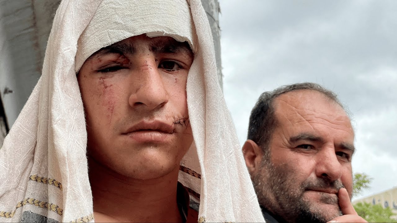 Kabul mosque blast is 'a reminder,' says NGO hospital