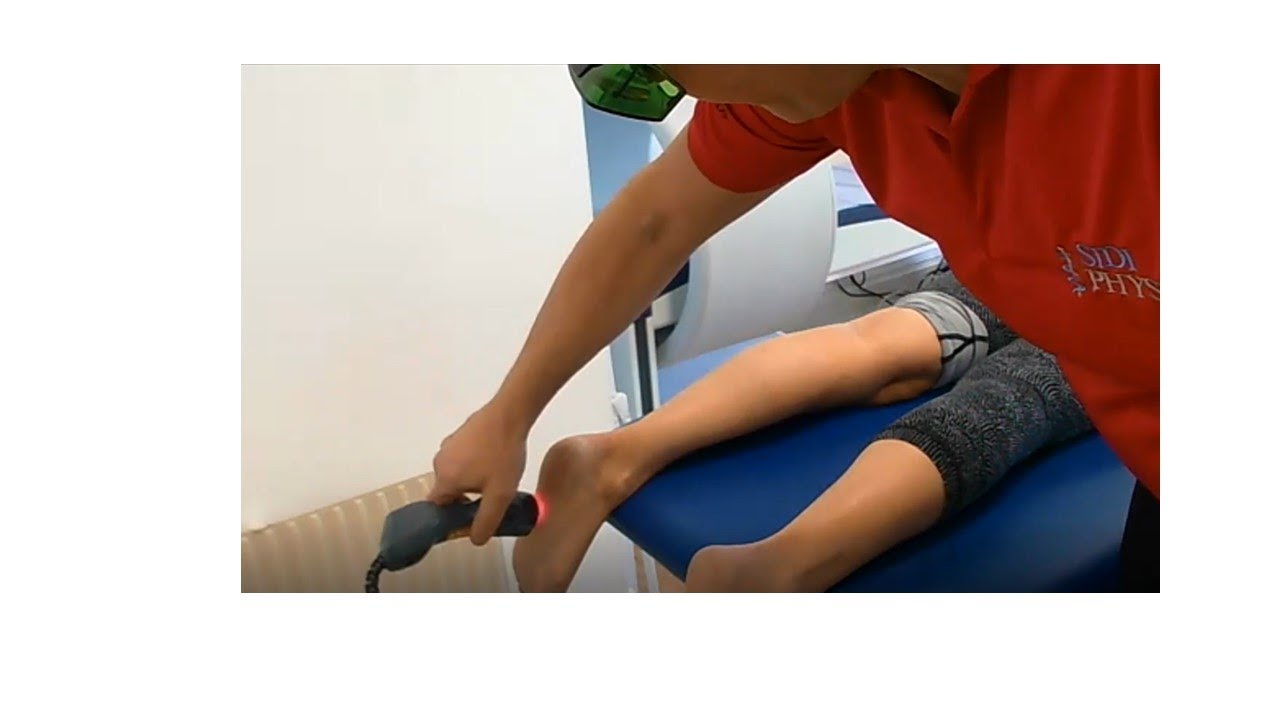 Treating plantar fasciitis with MLS Class 4 laser