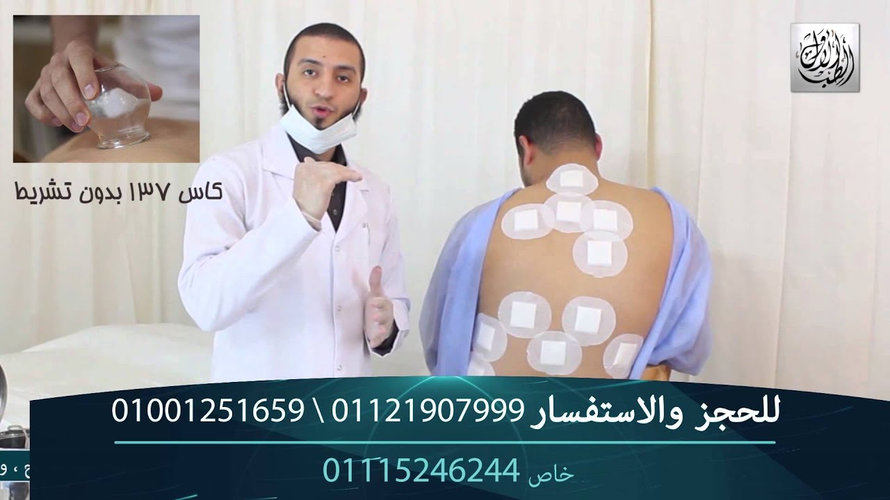 مواضع الحجامة الصحيحة لامراض الجهاز الهضمى \ اخصائى الطب التكميلى : احمد الصاوى .