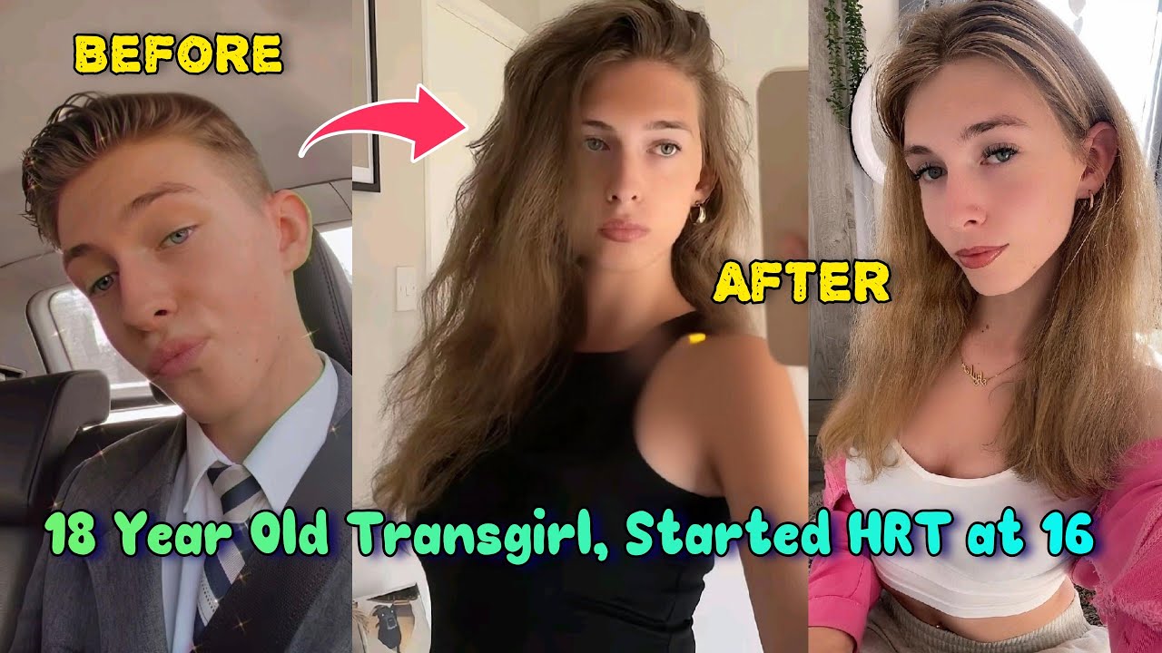 An 18 Year Old Transgirl Who Started HRT at The Age of 16 | Boy to Girl Transition | MTF
