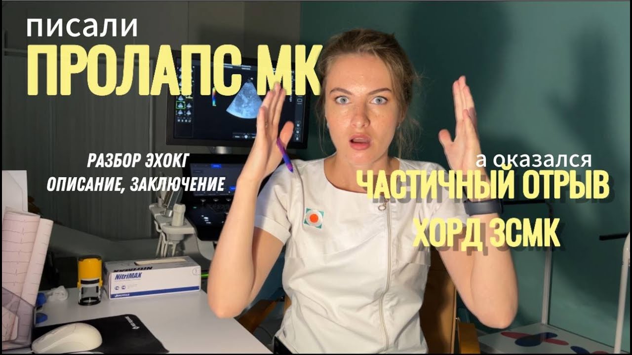 Писали ПРОЛАПС митрального клапана, а оказался ЧАСТИЧНЫЙ ОТРЫВ ХОРД! Эхокардиография. Разбор ЭхоКГ