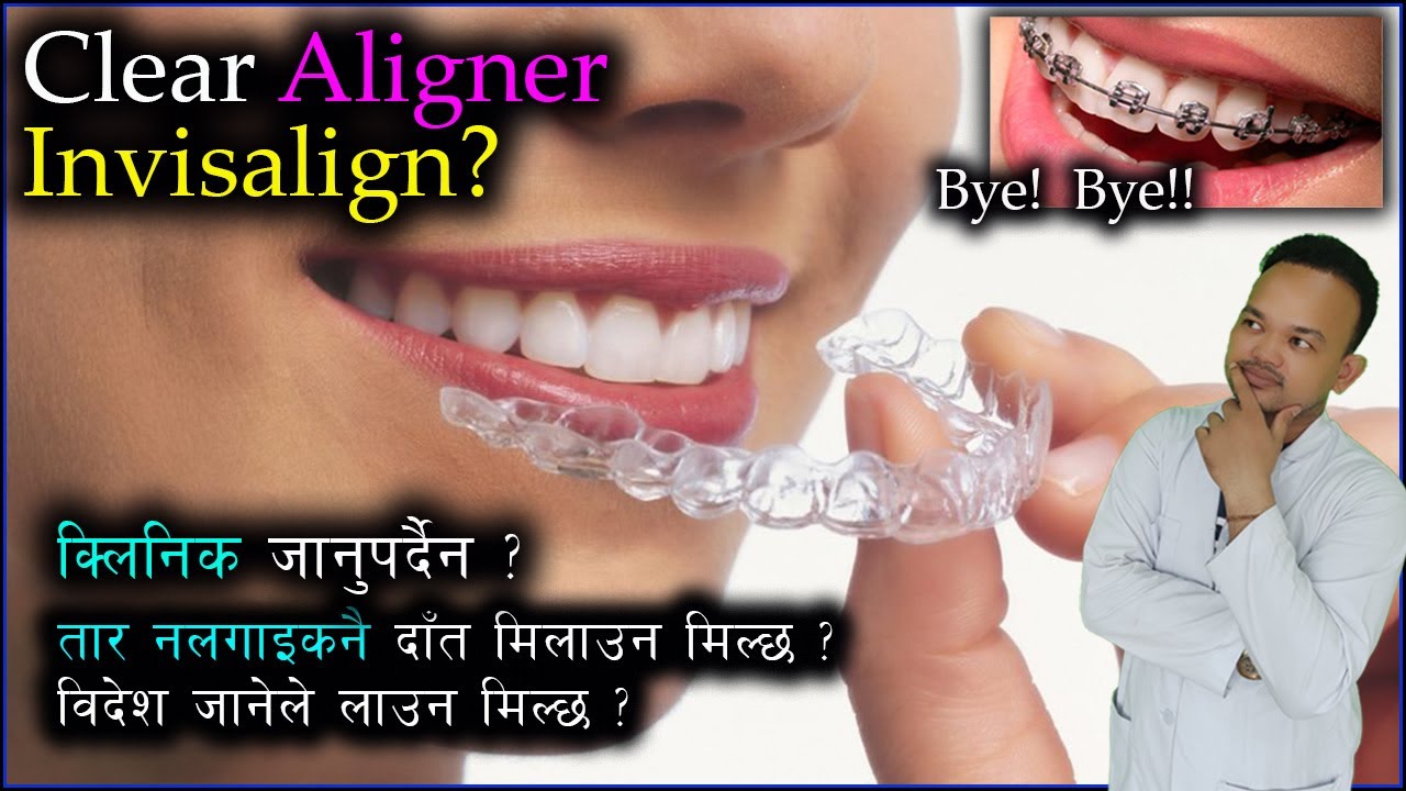 What is Clear Aligner/ Invisalign?/Gap banda kasari garne/Midline diastema/ Cosmetic Dentist/Doc Taj