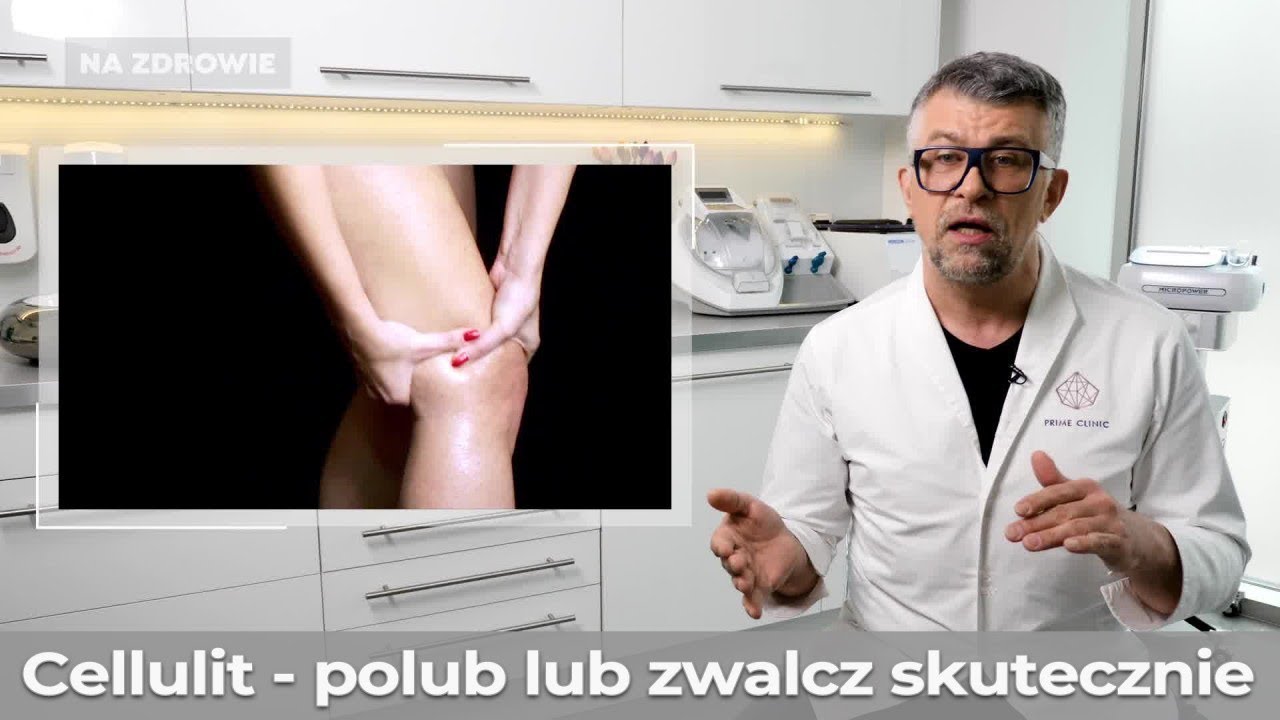 Czym jest cellulit i jak można go zwalczać?