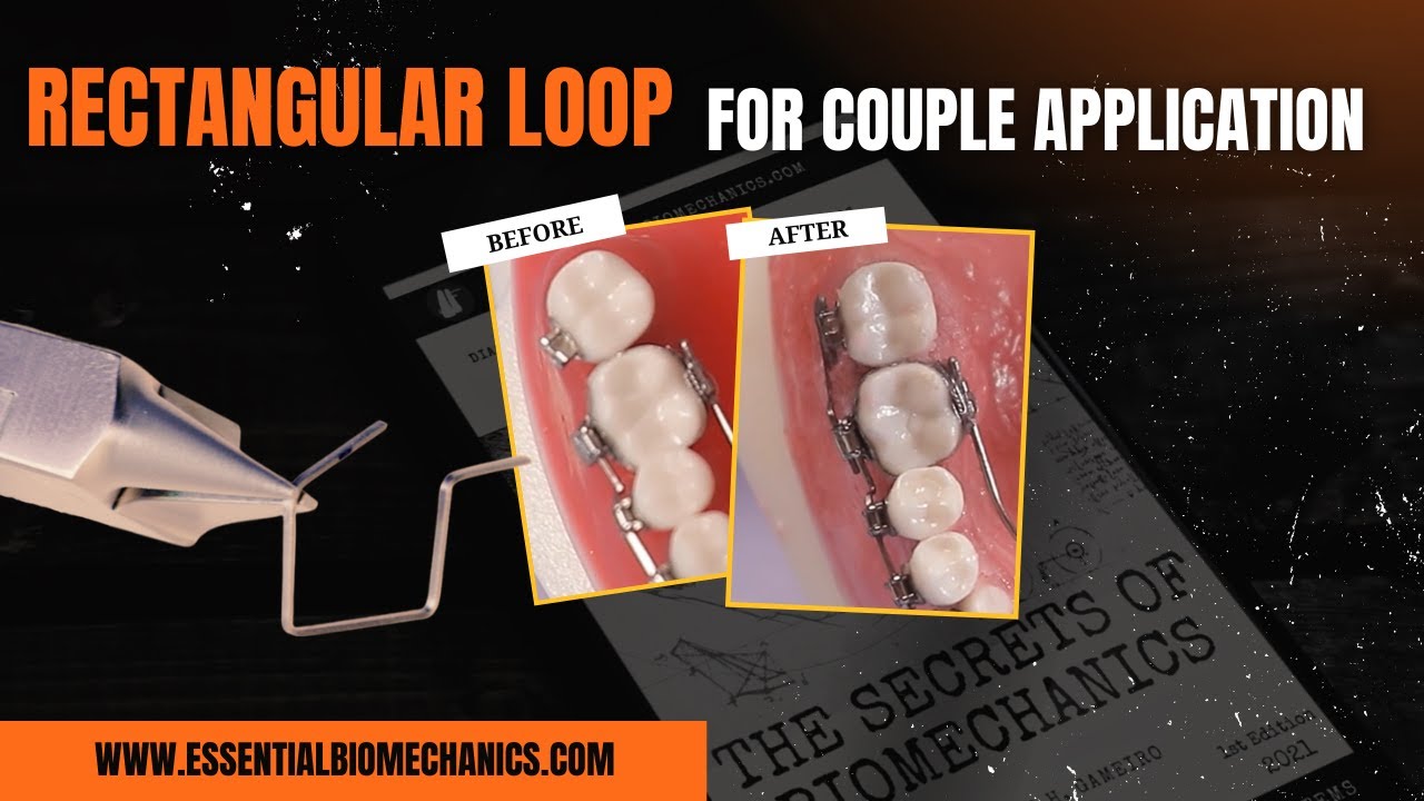 Rectangular_Loop_for_Couple_Application | Essential Biomechanics