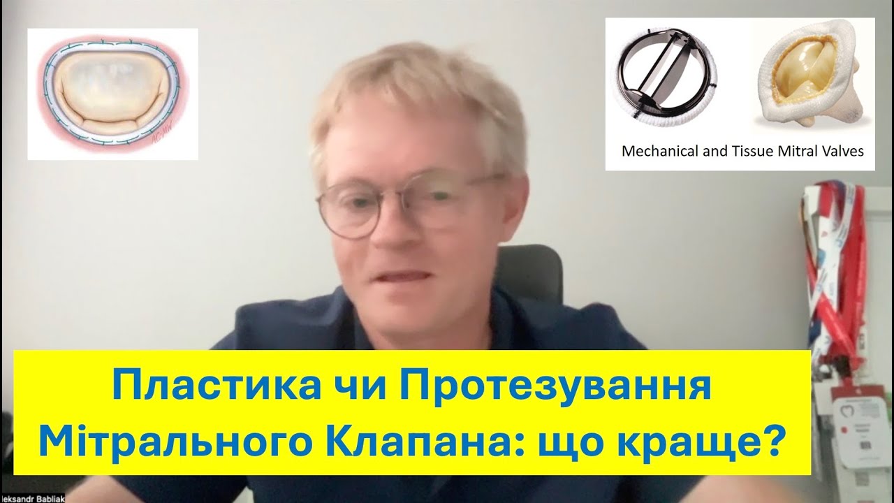Пластика чи протезування мітрального клапана?