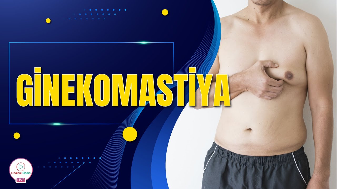 KİŞİLƏRDƏ SÜD VƏZİNİN BÖYÜMƏSİ / GİNEKOMASTİYA / KİŞİLƏRDƏ SİNƏ SALLANMASININ SƏBƏBİ