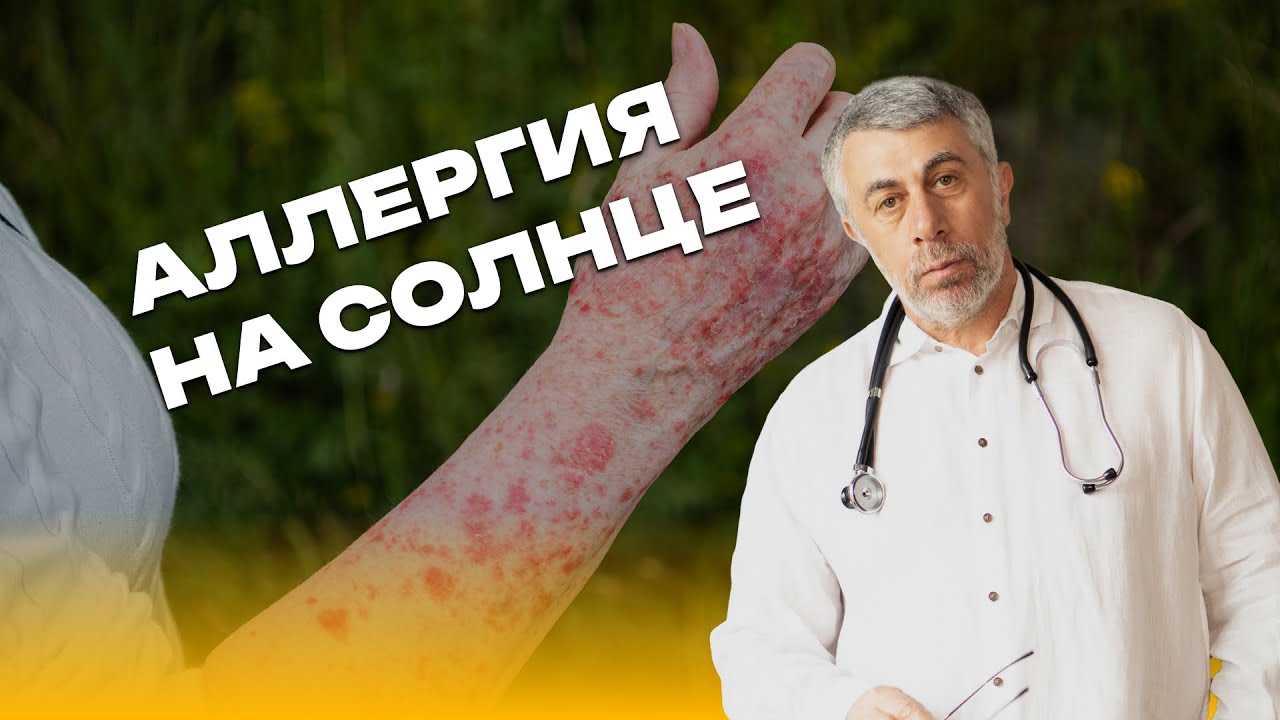 Аллергия на солнце
