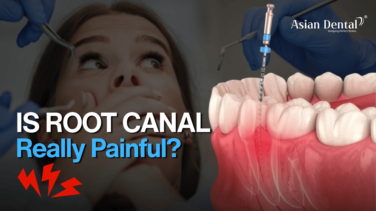 Do You Think Root Canal Is Really Painful? NO!