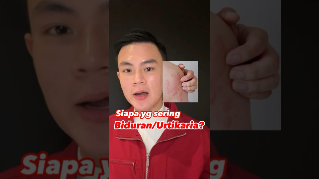 Siapa Yang Sering Biduran/Urtikaria ??