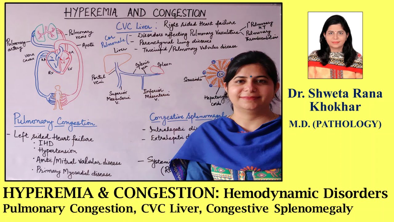 HYPEREMIA & CONGESTION: Pulmonary Congestion | CVC Liver | Congestive Splenomegaly |