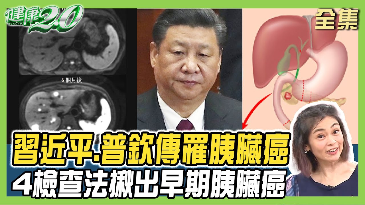 習近平 普欽 驚傳罹胰臟癌？ 5大胰臟癌高危險因子應篩檢 6大營養素養好胰臟！ 健康2.0 20240317【完整版】 鄭凱云 章明珠 王心儀 黃淑惠 洪素卿 雷議宗@tvbshealth20
