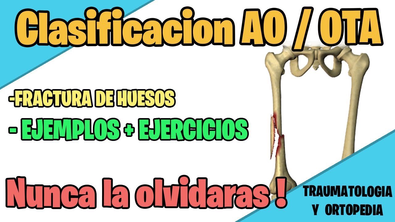 CLASIFICACION AO PARA FRACTURAS DE HUESOS / OTA MEJOR EXPLICADO