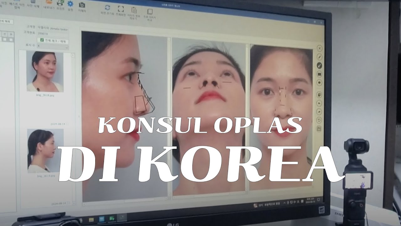 DOKTER OPLAS KOREA BILANG MUKAKU...... | AMELICANO