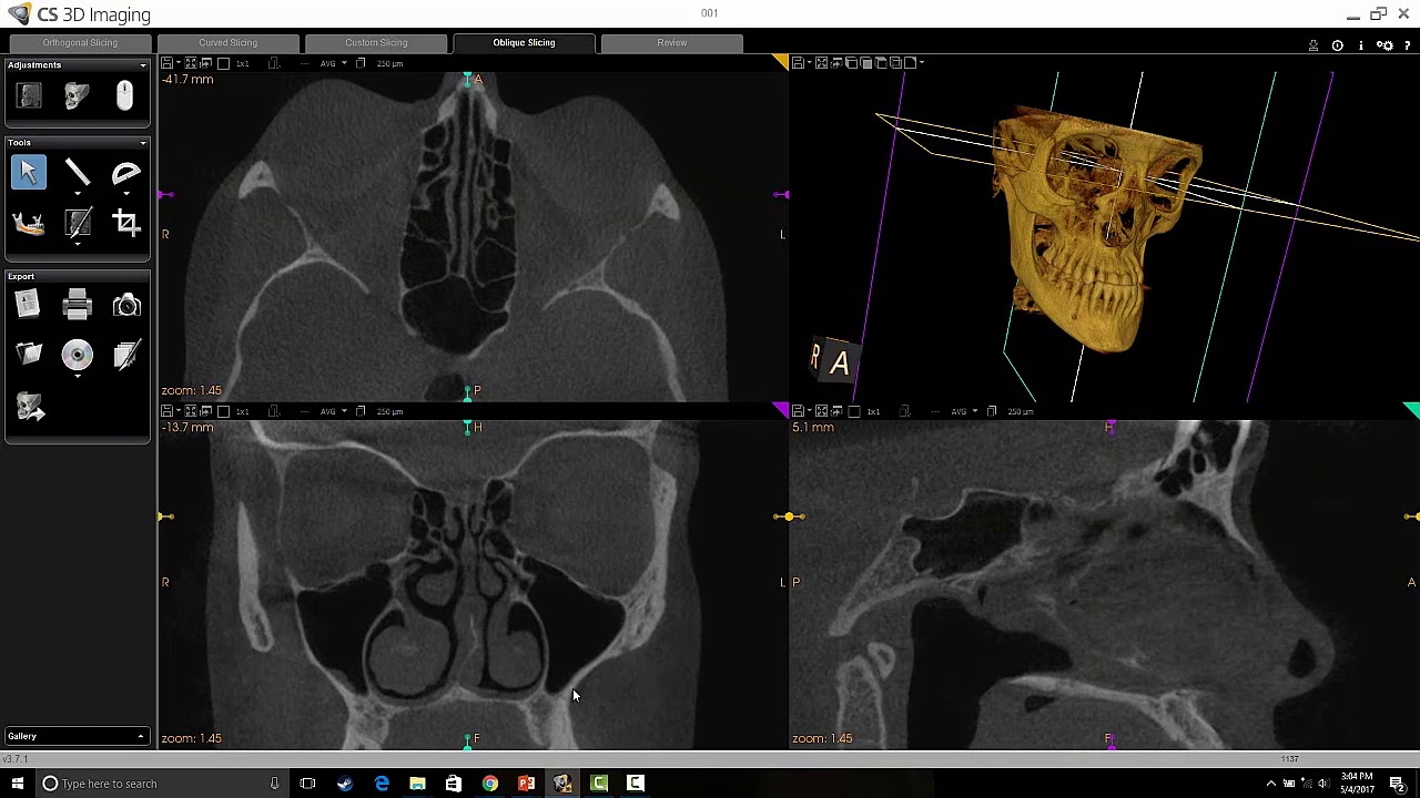 Carestream 3D Imaging - Full Skull Overview Dr. Steven Singer, Rutgers