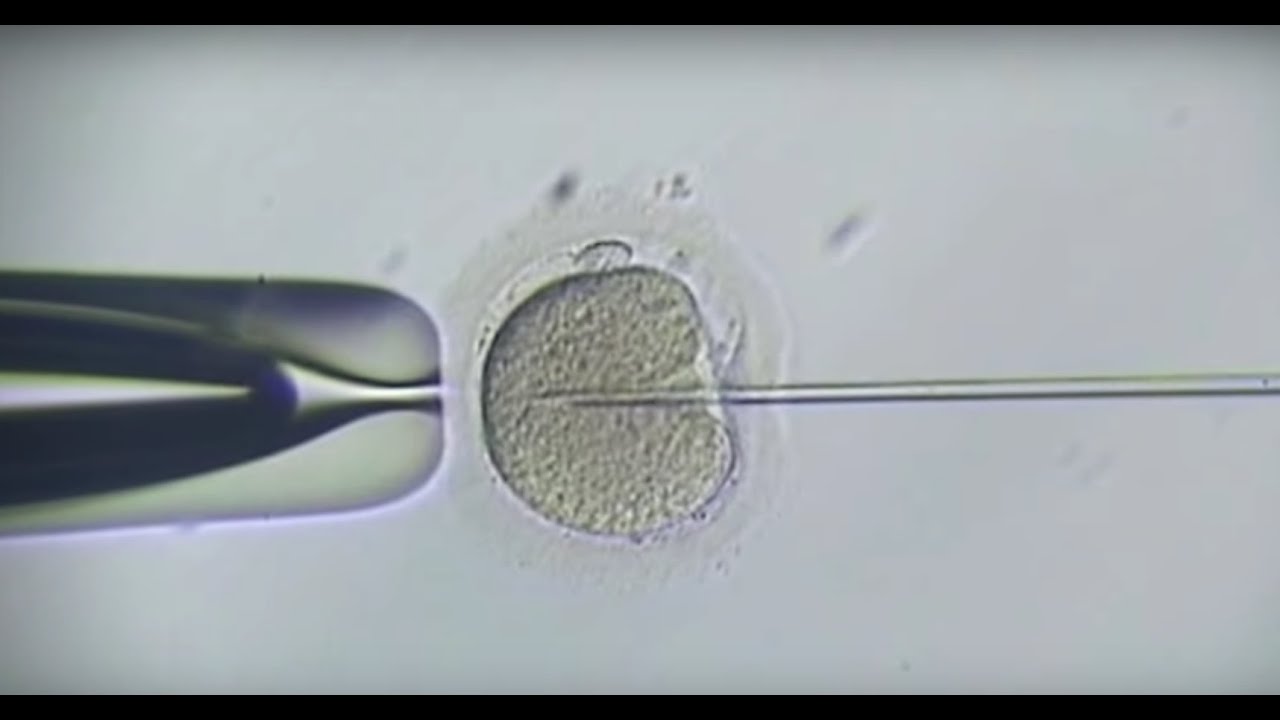 GYN-FIV - Liečba neplodnosti, IVF (Fertility treatment, IVF)