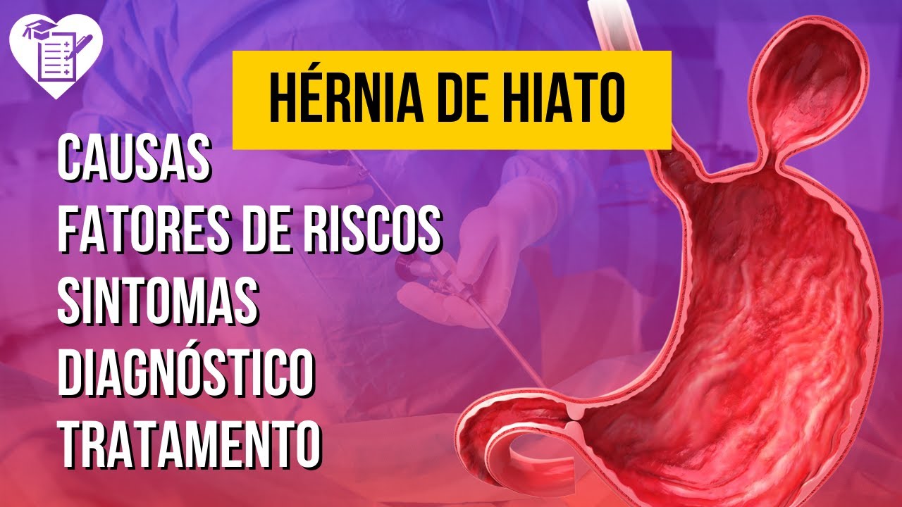 HÉRNIA DE HIATO - Tipos, Causas, Sintomas, Diagnóstico, Tratamento e Cirurgia de hérnia de hiato