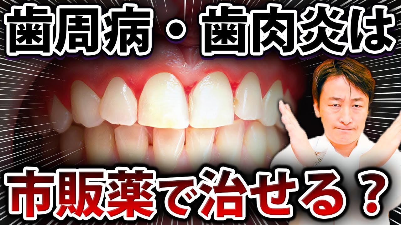 自力で歯周病・歯肉炎は治せるのか歯医者が解説します【歯周病の治し方】