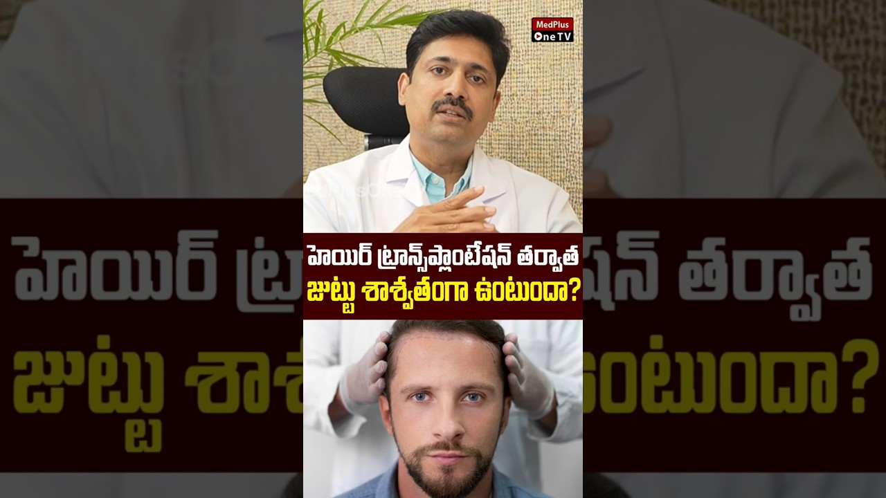 Watch This Before Planning For Hair Transplant Surgery | Dr. Ravi Chander @MedPlusONETV