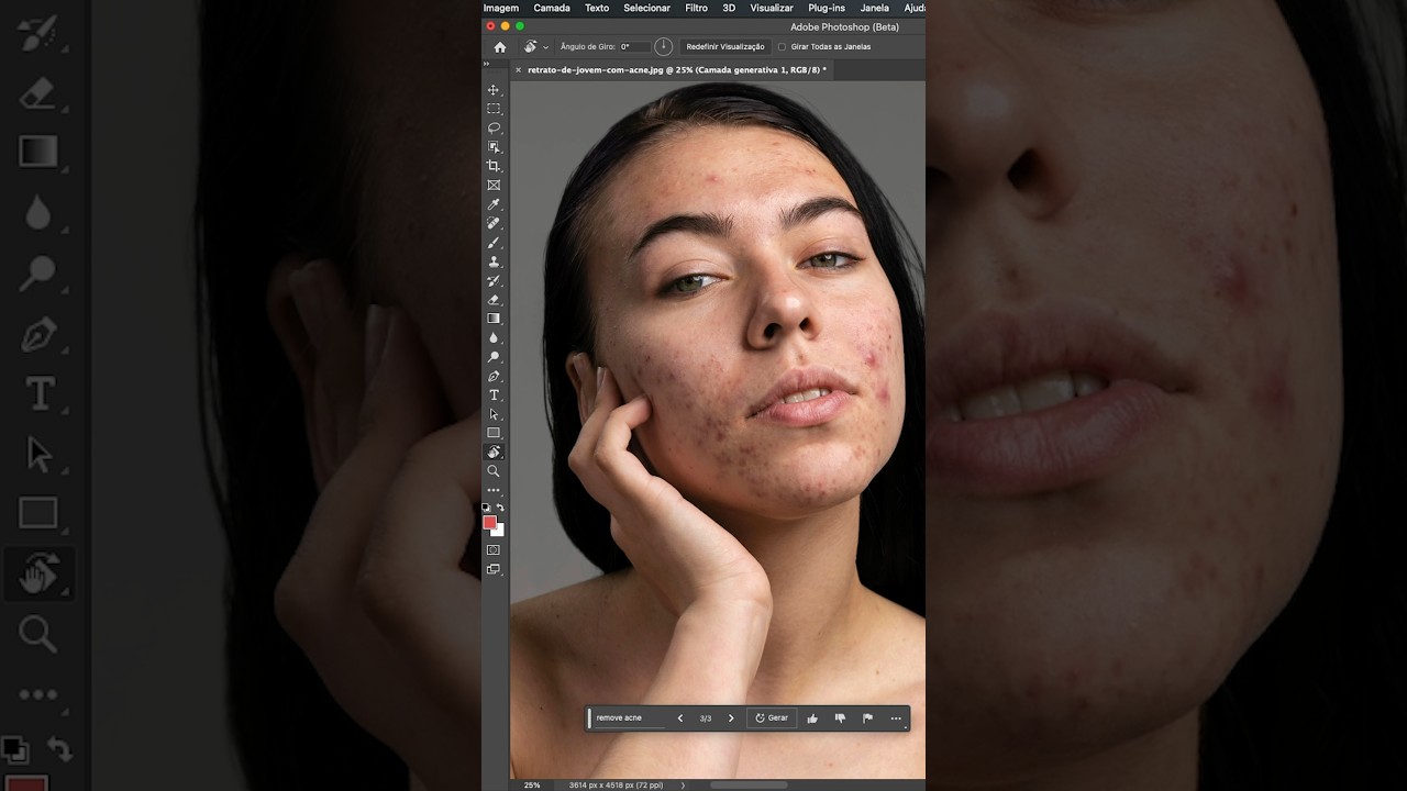 Editando pele com acne com intelig&ecirc;ncia artificial do Photoshop